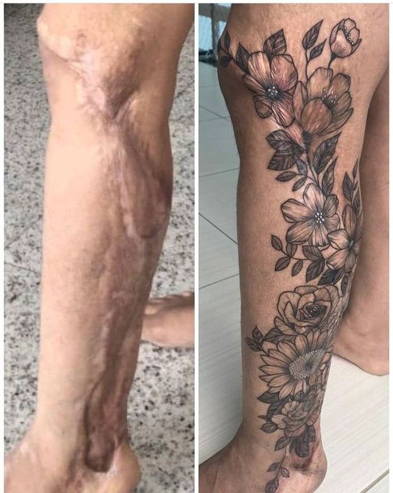 Hình xăm hoa trên chân phong cách blackwork, che sẹo, chi tiết cao, độ phân giải HD.