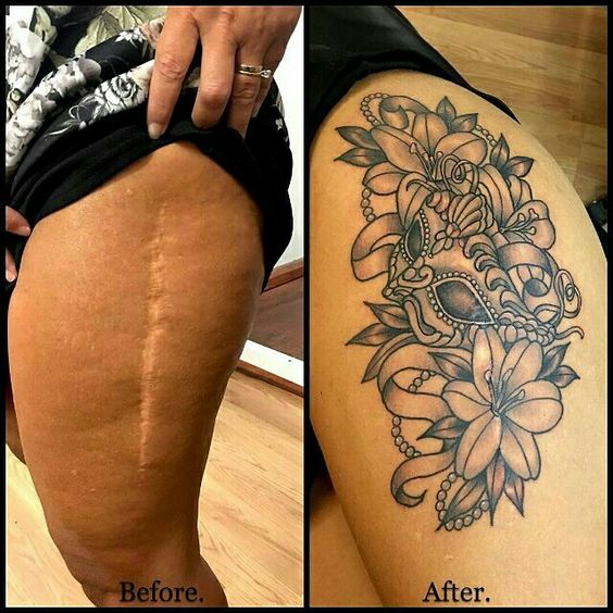 Hình xăm hoa che sẹo trên đùi, phong cách blackwork, chi tiết rõ nét, độ phân giải HD.