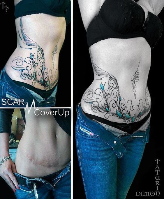 Hình xăm hoa lá che sẹo vùng bụng, phong cách blackwork, chi tiết, ảnh HD.