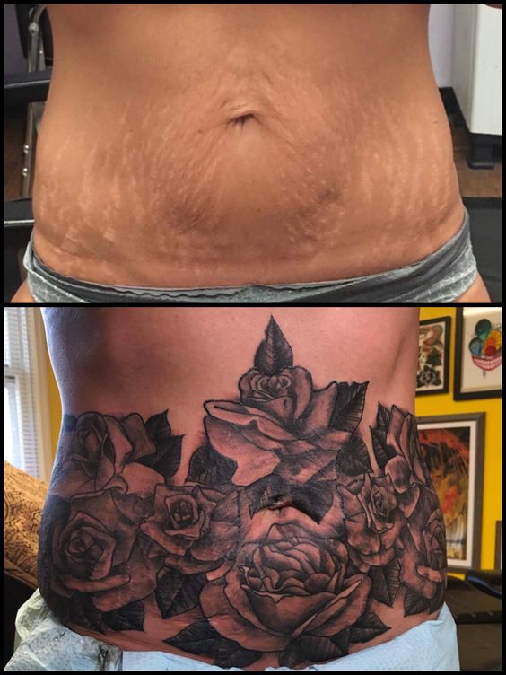 Hình xăm hoa hồng blackwork trên bụng, chi tiết rõ nét, độ phân giải HD.